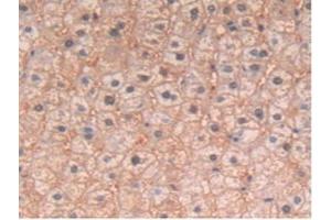 Detection of IL4 in Human Liver Tissue using Polyclonal Antibody to Interleukin 4 (IL4) (IL-4 antibody  (AA 25-153))