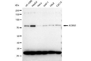 Western blotting analysis using ACSS2 antibody (ABIN7797499). (Recombinant ACSS2 antibody)