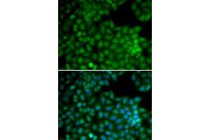 Immunofluorescence analysis of U20S cell using CDK7 antibody. (CDK7 antibody  (AA 1-346))