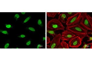 ICC/IF Image DNA ligase III antibody [C2C3], C-term detects DNA ligase III protein at nucleus by immunofluorescent analysis. (LIG3 antibody  (C-Term))