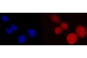 IF analysis of PCBP2/hnRNP E2 using anti-PCBP2/hnRNP E2 antibody (ABIN7600448). (PCBP2 antibody  (AA 197-276))