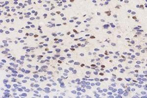 Immunohistochemistry analysis of paraffin-embedded mouse fetal rat hippocampus using PAX7 (ABIN7074973) at dilution of 1: 4200 (PAX7 antibody)