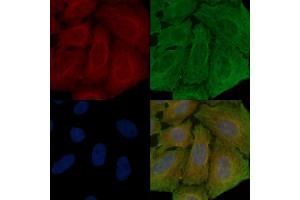 ABIN6259023 and ABIN6273879 staining Hela cells(30 min of UV treatment) by IF/ICC. (LGR4 antibody  (C-Term))