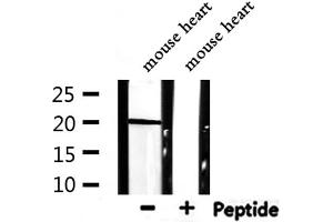 Western blot analysis of extracts from mouse heart, using ARF1 Antibody. (ARF1 antibody  (Internal Region))
