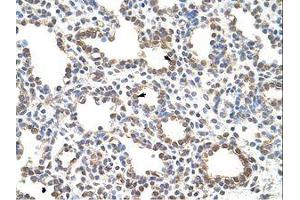 Image no. 1 for anti-Zinc Finger Protein 195 (ZNF195) (N-Term) antibody (ABIN6736198) (ZNF195 antibody  (N-Term))