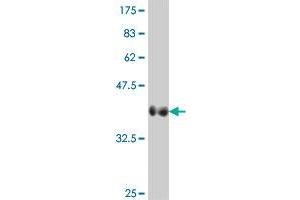 Western Blot detection against Immunogen (37. (VIPR2 antibody  (AA 24-126))