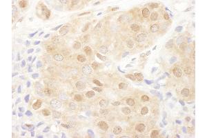 Immunohistochemistry (IHC) image for anti-Proteasome (Prosome, Macropain) 26S Subunit, Non-ATPase, 2 (PSMD2) (AA 50-100) antibody (ABIN7454976) (PSMD2 antibody  (AA 50-100))