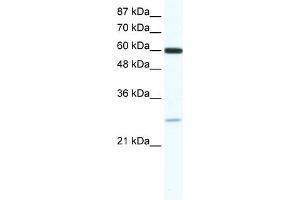 WB Suggested Anti-ZFP91 Antibody   Titration: 0. (ZFP91 antibody  (N-Term))