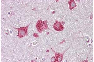 Anti-HEXA antibody IHC staining of human brain, cortex. (Hexosaminidase A antibody  (AA 431-480))