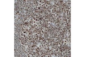 Immunohistochemical staining (Formalin-fixed paraffin-embedded sections) of human tonsil with REST monoclonal antibody, clone CL0381  shows strong nuclear immunoreactivity in the lymphoid cells. (REST antibody)