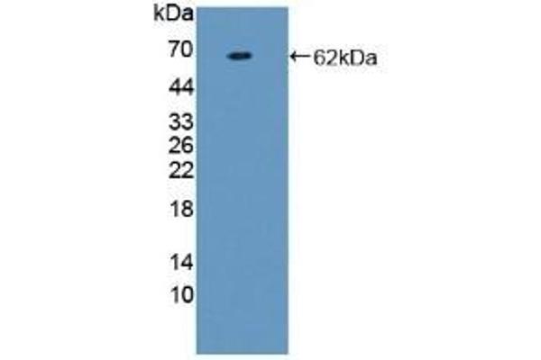 Prothrombin Fragment 1+2 antibody