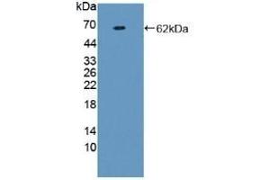 Detection of Recombinant F1+2, Human using Polyclonal Antibody to Prothrombin Fragment 1+2 (F1+2) (Prothrombin Fragment 1+2 antibody)