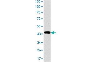 Western blot analysis using TNNI2 monoclonal antobody, clone 2F12A8  against recombinant human TNNI2 protein.