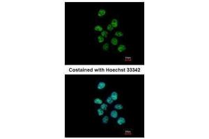 ICC/IF Image Immunofluorescence analysis of paraformaldehyde-fixed A431, using PUF60, antibody at 1:500 dilution. (PUF60 antibody  (C-Term))