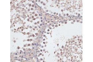 Immunohistochemistry of paraffin-embedded Rat testis using CCNE2 Polyclonal Antibody at dilution of 1:100 (40x lens).