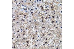 Immunohistochemistry (Paraffin-embedded Sections) (IHC (p)) image for anti-Eukaryotic Translation Initiation Factor 4 gamma 2 (EIF4G2) (AA 750-850) antibody (ABIN3016941)