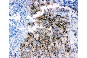 IHC-P staining of rat spleen tissue (CD79b antibody  (AA 29-229))