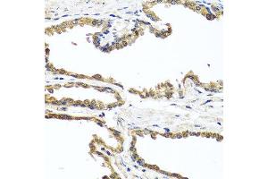Immunohistochemistry of paraffin-embedded human prostate using OGFR antibody at dilution of 1:100 (x40 lens). (OGFR antibody)