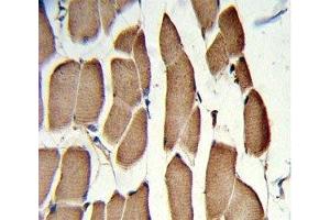 IHC analysis of FFPE human skeletal muscle with WNT5B antibody (WNT5B antibody  (AA 153-182))