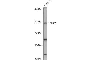 Western blot analysis of extracts of U-87MG cells, using PGBD1 antibody (ABIN7269372) at 1:1000 dilution. (PGBD1 antibody  (AA 150-450))