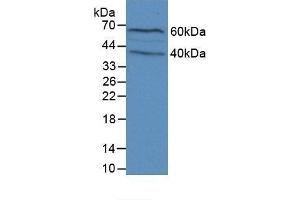 Detection of FLG in Mouse Brain Tissue using Polyclonal Antibody to Filaggrin (FLG) (Filaggrin antibody  (AA 119-336))