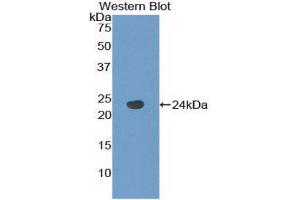 Western Blotting (WB) image for anti-Tachykinin Receptor 2 (TACR2) (AA 92-290) antibody (ABIN1860673) (TACR2 antibody  (AA 92-290))