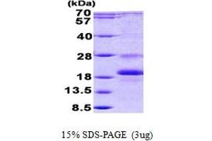 SDS-PAGE (SDS) image for Inhibitor of DNA Binding 1, Dominant Negative Helix-Loop-Helix Protein (ID1) (AA 1-155) protein (His tag) (ABIN7280218)