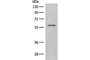 Western blot analysis of Mouse eye tissue lysate using SLC5A1 Polyclonal Antibody at dilution of 1:500 (SLC5A1 antibody)