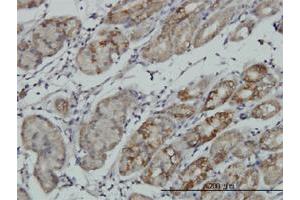 Immunohistochemistry (Formalin-fixed Paraffin-embedded Sections) (IHC (fp)) image for anti-Ribosomal Protein S6 Kinase, 90kDa, Polypeptide 6 (RPS6KA6) (AA 636-745) antibody (ABIN565375)