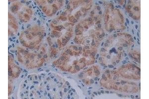 #VALUE! (SIVA1 antibody  (AA 1-175))