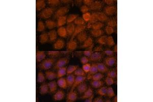 Immunofluorescence analysis of HeLa cells using NDUF antibody (ABIN7268807) at dilution of 1:100. (NDUFAF4 antibody  (AA 1-170))