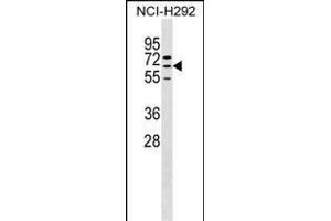 ZN Antibody (N-term) (ABIN1539295 and ABIN2849920) western blot analysis in NCI- cell line lysates (35 μg/lane).