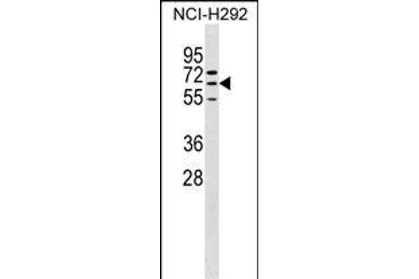 ZNF599 anticorps  (N-Term)