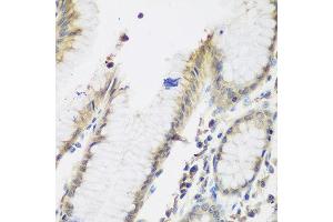 Immunohistochemistry of paraffin-embedded human stomach using NAA50 antibody at dilution of 1:200 (40x lens). (NAA50 antibody)
