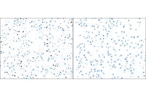 Immunocytochemistry (ICC) image for anti-Poly (ADP-Ribose) Polymerase 1 (PARP1) (AA 215-265) antibody (ABIN7455116) (Recombinant PARP1 antibody  (AA 215-265))