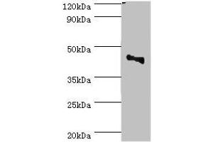 Western blot All lanes: CBX8 antibody at 2 μg/mL + Jurkat whole cell lysate Secondary Goat polyclonal to rabbit IgG at 1/10000 dilution Predicted band size: 43 kDa Observed band size: 43 kDa (CBX8 antibody  (AA 80-280))