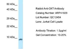 Host:  Rabbit  Target Name:  OXT  Sample Tissue:  Human Jurkat  Antibody Dilution:  1ug/ml (OXT antibody  (N-Term))
