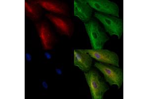 ABIN6257285 and ABIN6273674 staining  cells by IF/ICC. (Integrin beta 7 antibody  (Internal Region))
