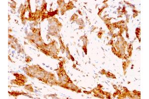 Immunohistochemistry (IHC) image for anti-Heat Shock Protein 90kDa beta (Grp94), Member 1 (HSP90B1) antibody (ABIN6940802)
