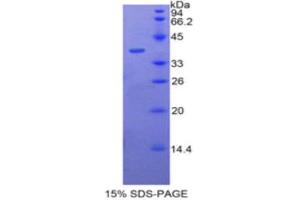 SDS-PAGE (SDS) image for Bactericidal/Permeability Increasing Protein (BPI) (AA 140-250) protein (His tag,GST tag) (ABIN1877636)