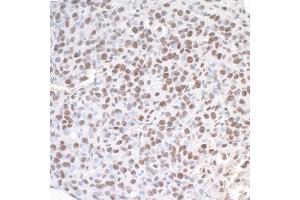 Immunohistochemistry (IHC) image for anti-Achaete-Scute Complex Homolog 2 (ASCL2) (AA 225-275) antibody (ABIN7454590) (ASCL2 antibody  (AA 225-275))