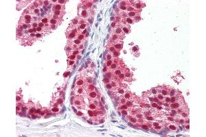 Anti-RXRB antibody IHC of human prostate. (Retinoid X Receptor beta antibody  (Hinge Region))