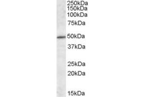EB09292 (1µg/ml) staining of Mouse Brain lysate (35µg protein in RIPA buffer). (IFT57 antibody  (Internal Region))