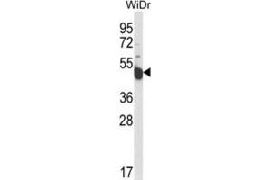 Western Blotting (WB) image for anti-Inscuteable Homolog (INSC) antibody (ABIN3004284) (INSC antibody)