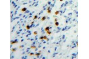 Used in DAB staining on fromalin fixed paraffin-embedded Spleen tissue (HAT1 antibody  (AA 100-338))