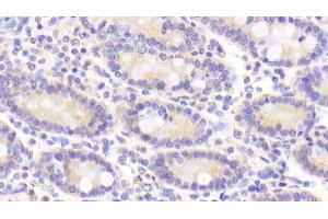 Immunohistochemistry (IHC) image for anti-Transferrin Receptor (p90, CD71) (TFRC) (AA 578-765) antibody (ABIN7437038)