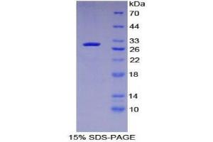 SDS-PAGE (SDS) image for Mitogen-Activated Protein Kinase Kinase Kinase Kinase 5 (MAP4K5) (AA 9-231) protein (His tag) (ABIN1879352) (MAP4K5 Protein (AA 9-231) (His tag))