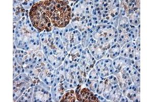 Immunohistochemical staining of paraffin-embedded liver tissue using anti-HSP90AA1mouse monoclonal antibody. (HSP90AA1 antibody)
