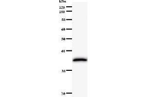 Western Blotting (WB) image for anti-Excision Repair Cross-Complementing Rodent Repair Deficiency, Complementation Group 8 (ERCC8) antibody (ABIN931164) (ERCC8 antibody)