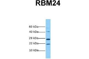 Host:  Rabbit  Target Name:  RBM24  Sample Tissue:  Human MCF7  Antibody Dilution:  1. (RBM24 antibody  (Middle Region))